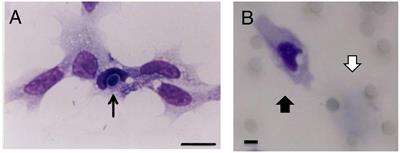 Chemotaxis Assay for Marsupenaeus japonicas Hemocytes and Application for the Development of an Oral Immunostimulant Against White Spot Syndrome Virus